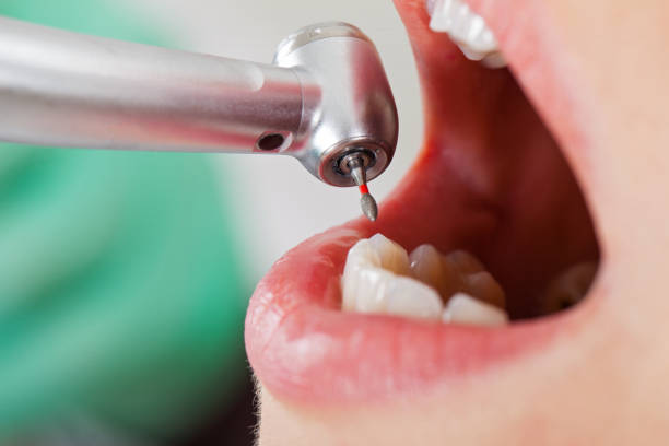 Best Emergency Tooth Extraction in Enfield, NC
